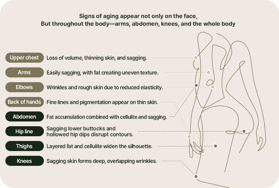Changes in body lines are caused by a loss of elasticity