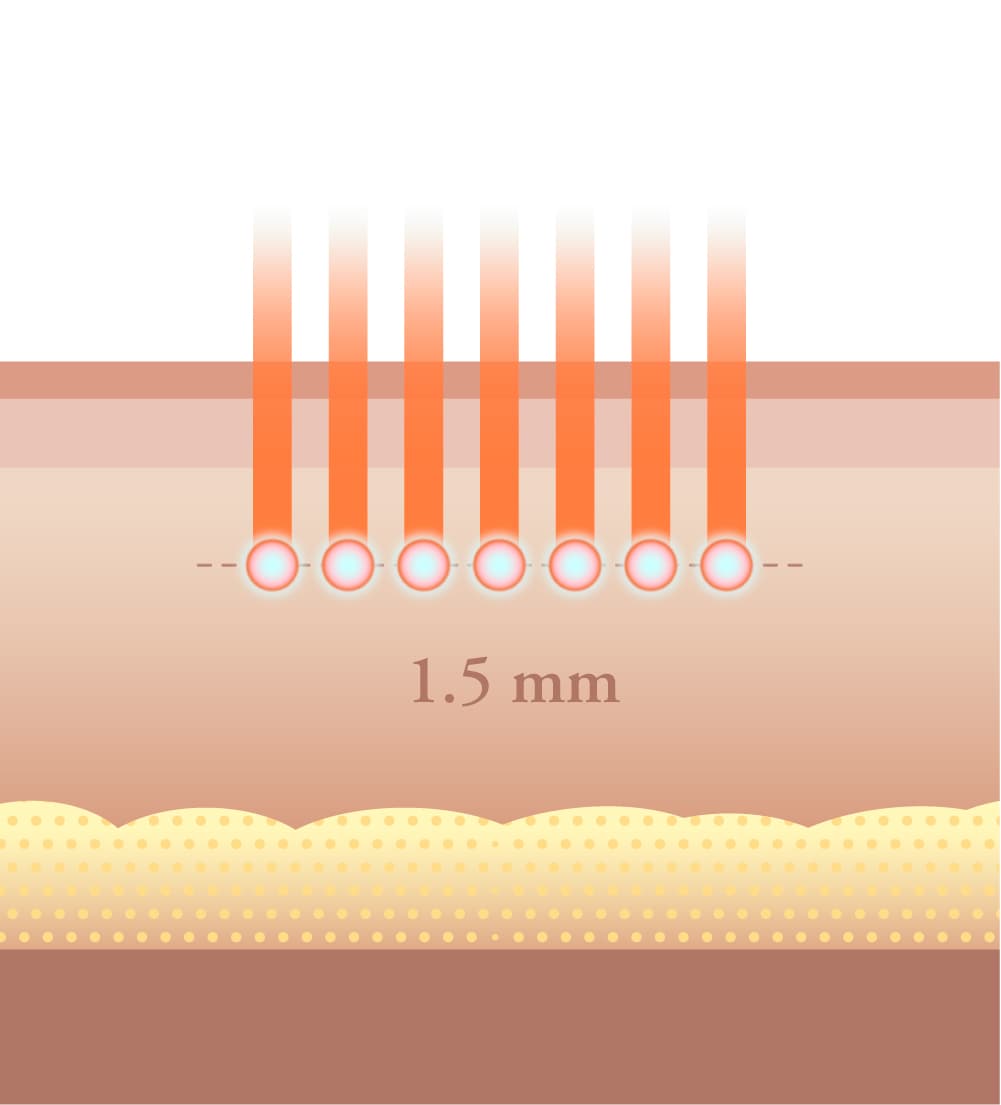 Sofwave — DA Dermatology Dosan