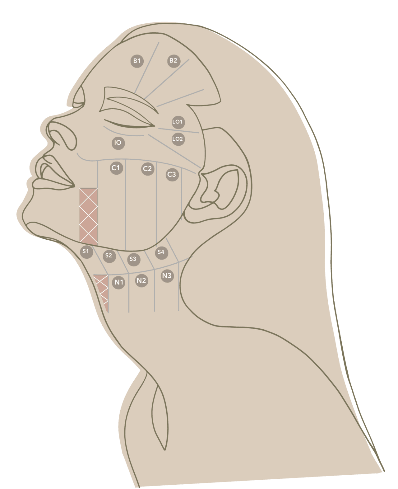 Ulthera design chart — 1:1 customized anti-aging mapping at DA Dermatology Dosan